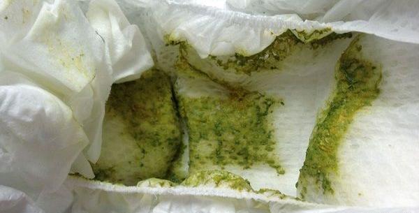 عکس مدفوع نوزاد چهل روزه