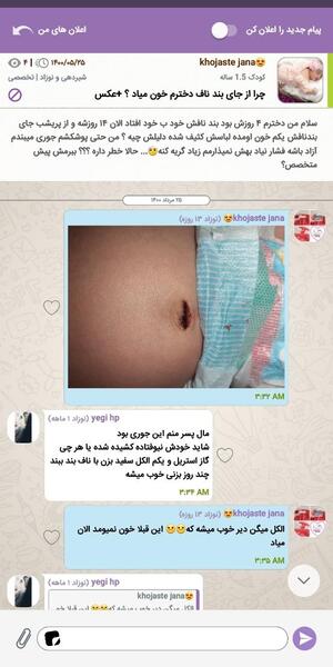 عکس ناف نوزاد چهل روزه