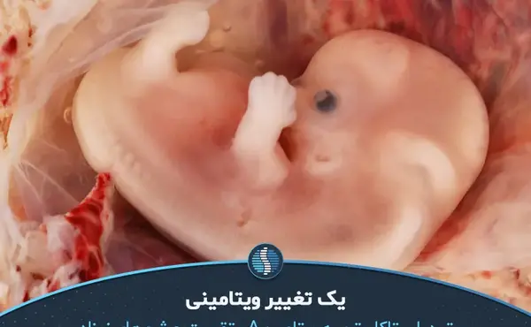 عکس نوزاد های چشم رنگی