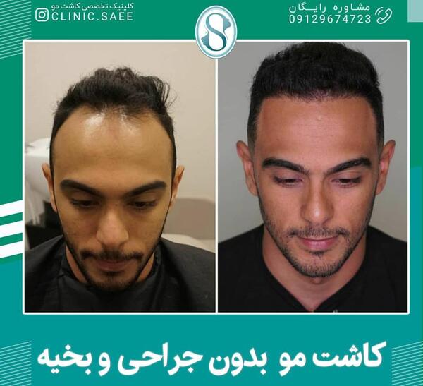 عکس موموی اصلی