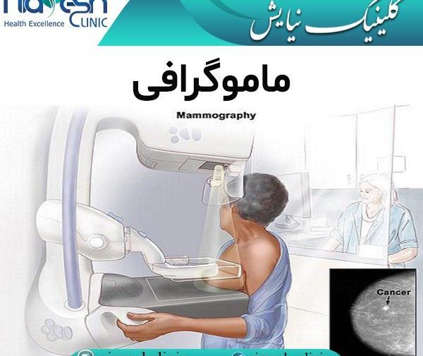عکس ماموگرافی سرطان