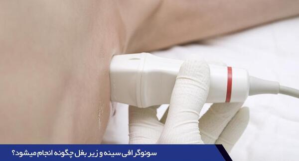 عکس ماموگرافی زیر بغل