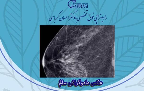 عکس ماموگرافی زیر بغل