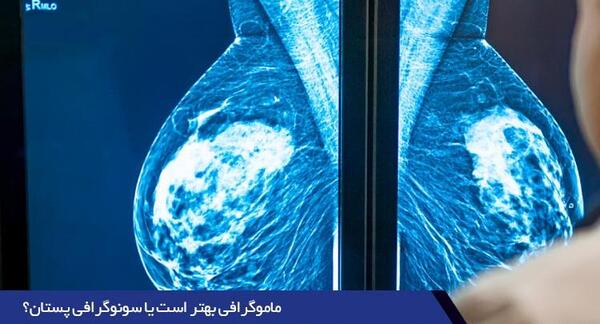 عکس ماموگرافی زیر بغل