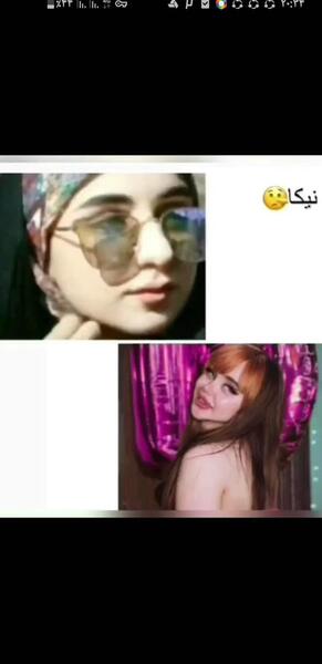 عکس مومو قبل از عمل نی نی سایت