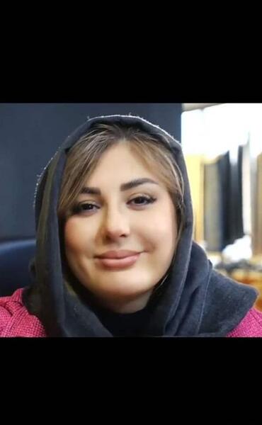 عکس مومو قبل از عمل نی نی سایت