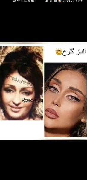 عکس مومو قبل از عمل نی نی سایت