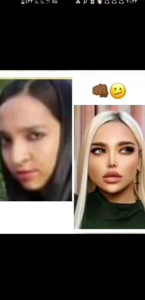 عکس مومو قبل از عمل نی نی سایت
