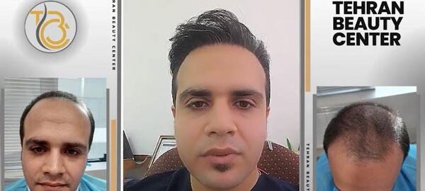 عکس مومو قبل از عمل و بعد از عمل
