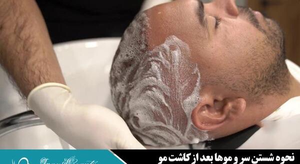 عکس مومو قبل از عمل و بعد از عمل