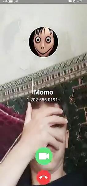 عکس های مومو قبل از عمل