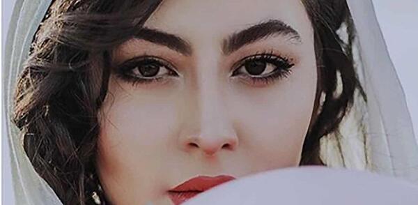 عکس مومو بعد از عمل زیبایی