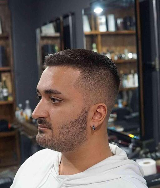 عکس مو مردانه کچل