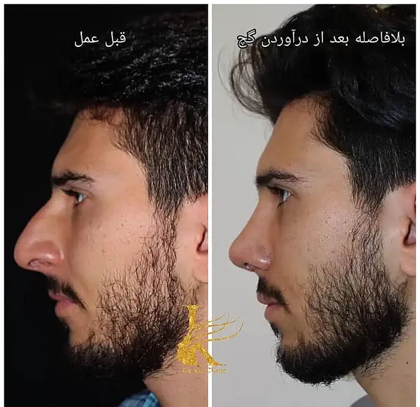 عکس بینی نیمه فانتزی مردانه