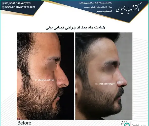 عکس بینی نیمه فانتزی مردانه