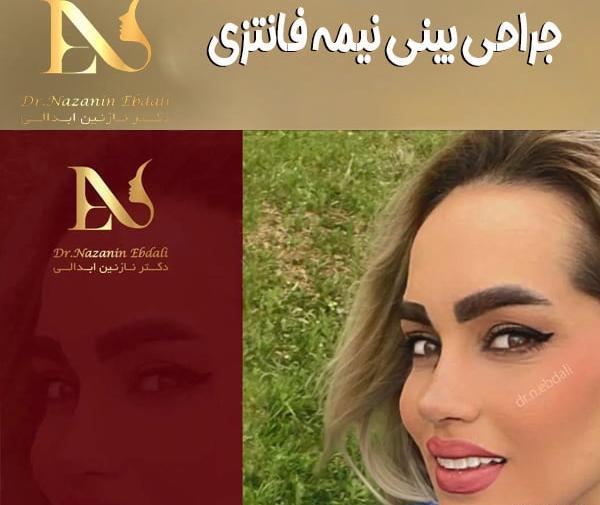 عکس بینی نیمه فانتزی مردانه