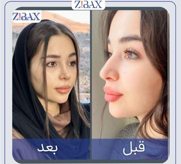 عکس بینی نیمه فانتزی مردانه