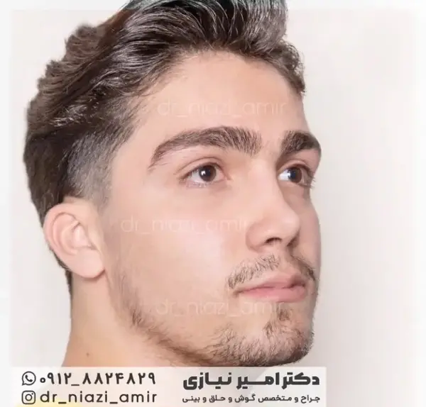 عکس بینی نیمه فانتزی مردانه