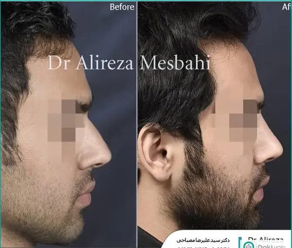 عکس بینی نیمه فانتزی مردانه