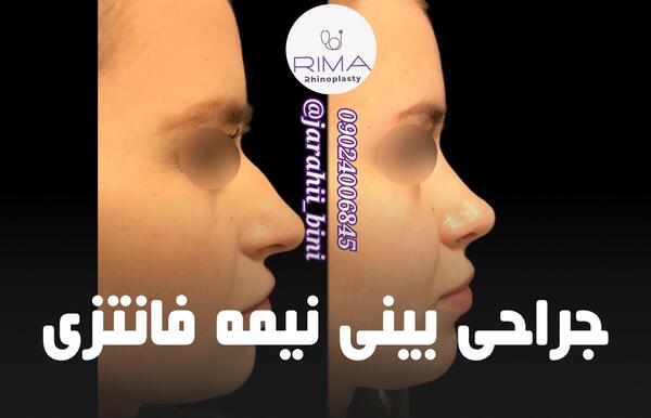 عکس بینی نیمه فانتزی مردانه