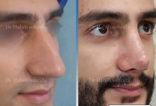 عکس بینی نیمه فانتزی مردانه