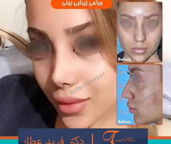عکس بینی نیمه فانتزی مردانه