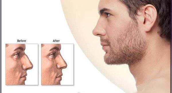 عکس بینی نیمه فانتزی مردانه