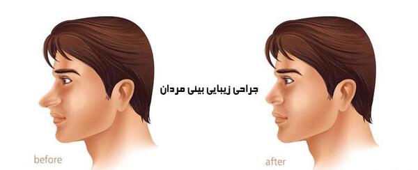 عکس بینی نیمه فانتزی مردانه