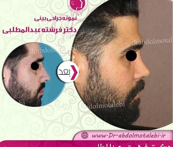 عکس بینی نیمه فانتزی مردانه