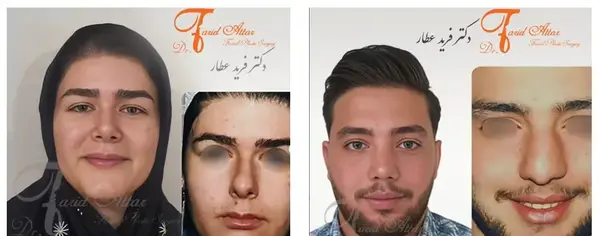 عکس بینی نیمه فانتزی مردانه
