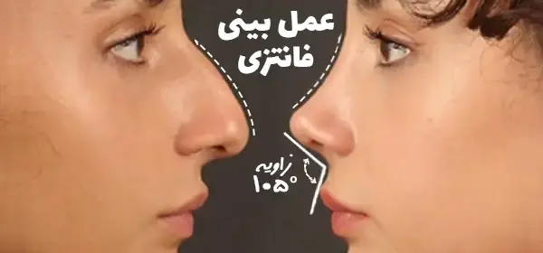 عکس بینی نیمه فانتزی مردانه