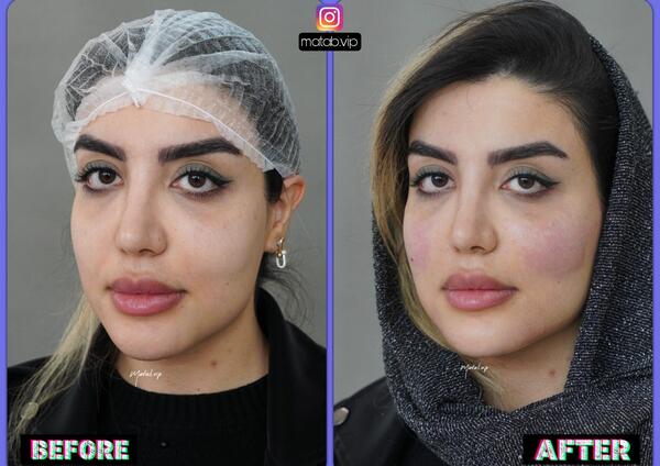 عکس زاویه سازی صورت مردانه