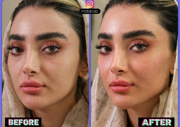 عکس زاویه سازی صورت مردانه