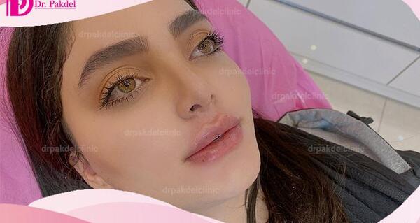 عکس زاویه سازی صورت مردانه
