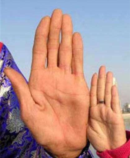 عکس مرد غول آسا