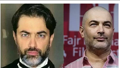 عکس مرد کچل با ریش بلند