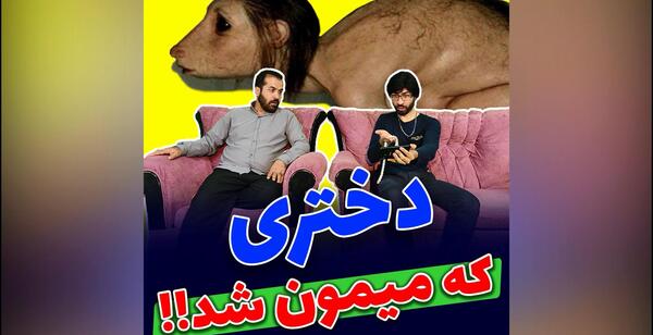 عکس دختری که شبیه میمون شد