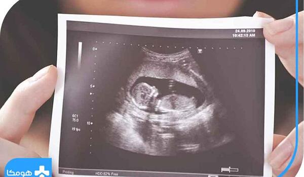 عکس جنین یک ماهه در شکم مادر