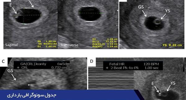عکس جدول ماه های بارداری