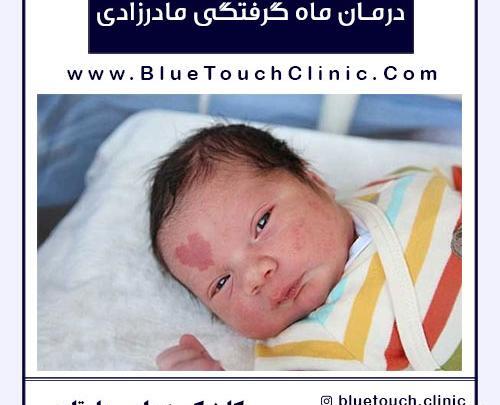 عکس لکه های ماه گرفتگی