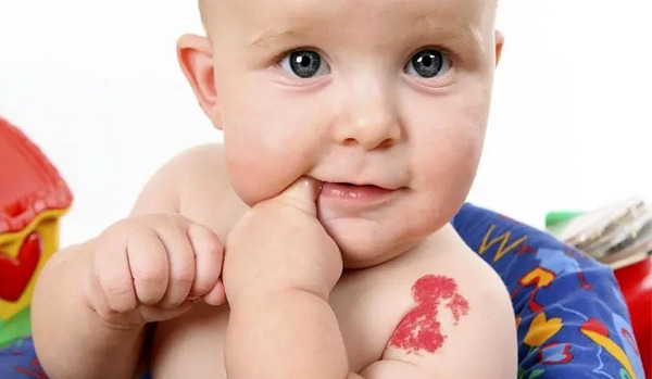 عکس لکه های ماه گرفتگی
