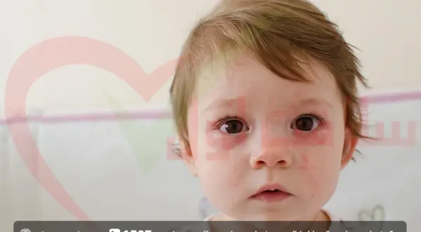 عکس ماه گرفتگی روی بدن نوزاد