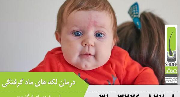 عکس ماه گرفتگی روی بدن نوزاد