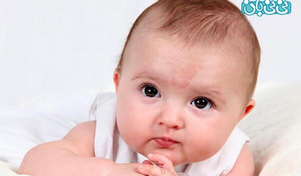 عکس ماه گرفتگی روی بدن نوزاد
