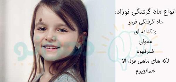 عکس ماه گرفتگی روی بدن نوزاد