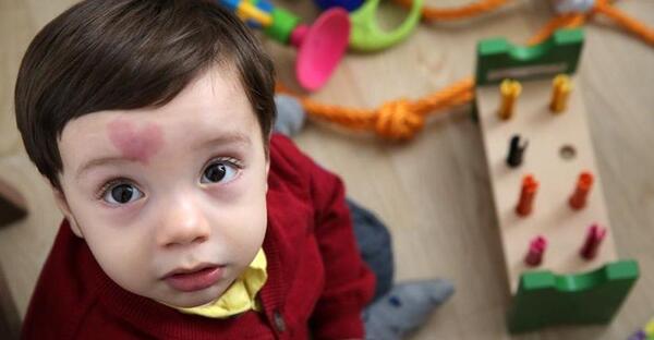 عکس ماه گرفتگی روی بدن نوزاد