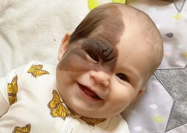عکس ماه گرفتگی روی بدن نوزاد