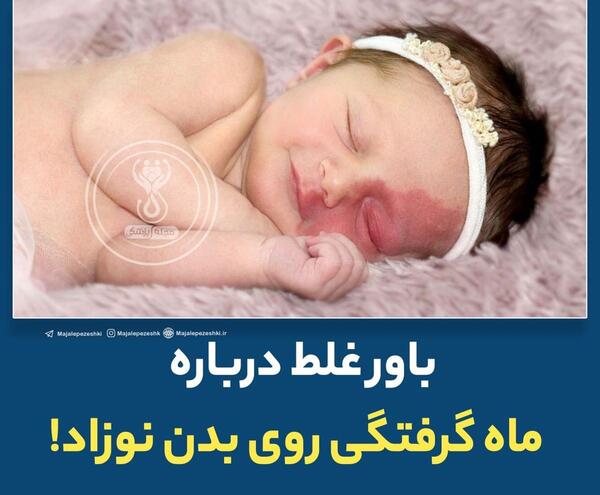 عکس ماه گرفتگی روی بدن نوزاد
