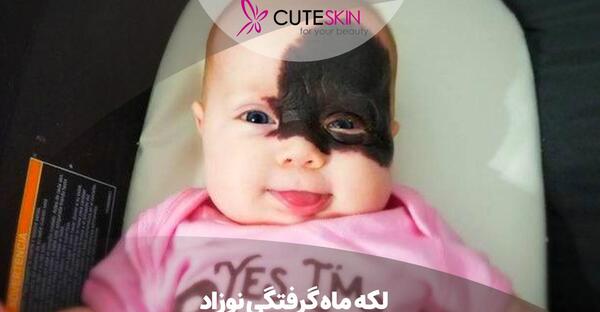 عکس ماه گرفتگی روی صورت نوزاد