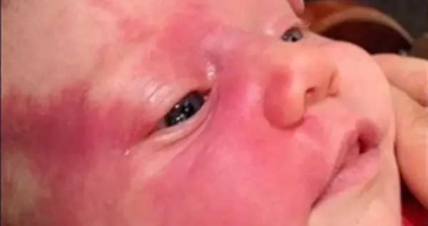 عکس ماه گرفتگی روی صورت نوزاد